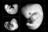 Ali ultrazvočni pregled ne vidi nosečnosti? Ali ultrazvočni pregled ne vidi zarodka